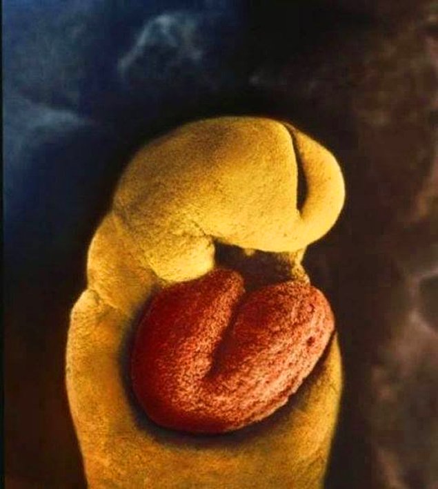 День 24: у эмбриона не развито никаких жизненно важных систем, кроме сердца, которое начинает биться с 18 дня