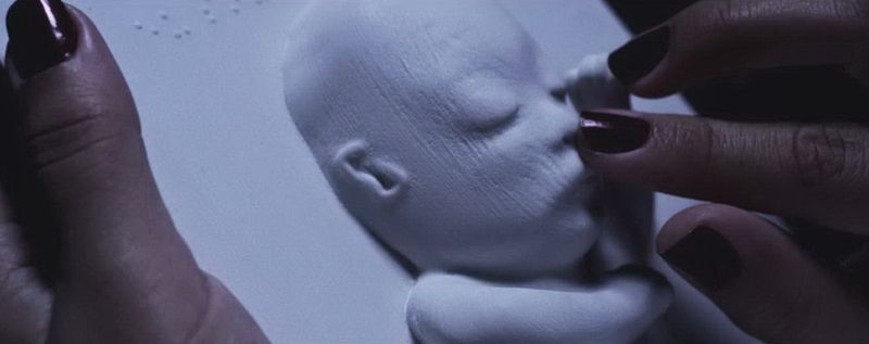 Слепая женщина пришла на УЗИ. То, что сделал врач - просто фантастика! Слепая женщина пришла на УЗИ. То, что сделал врач - просто фантастика!