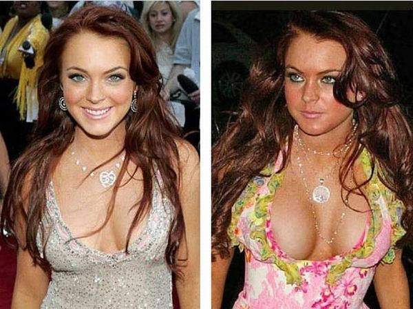 celebrities_before_and_after_boob_jobs_03