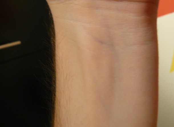 Wrist-610x446