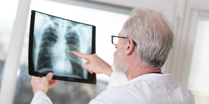 CanDis: антиоксидант глутатион позволяет раку распространяться в организме