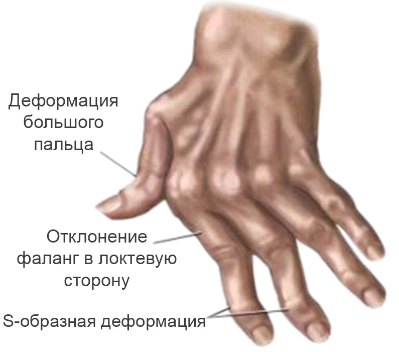 http://med36.com/files/uploads/images/ills/____________1.jpg