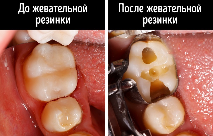 12 привычек, которые мы привыкли считать безобидными. А зря 12 привычек, которые мы привыкли считать безобидными. А зря