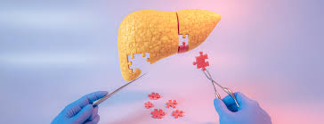 NatCom: стареющие «клетки-зомби» ускоряют развитие воспаления печени