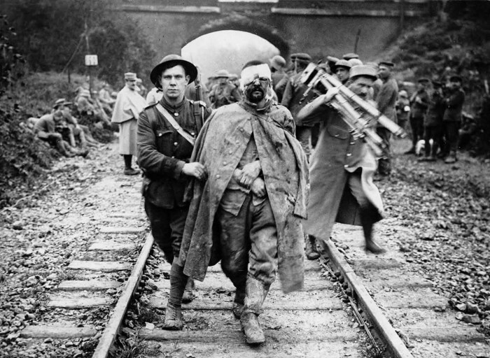 Раненый и грязный немецкий военнопленный. Раненый и грязный немецкий военнопленный.