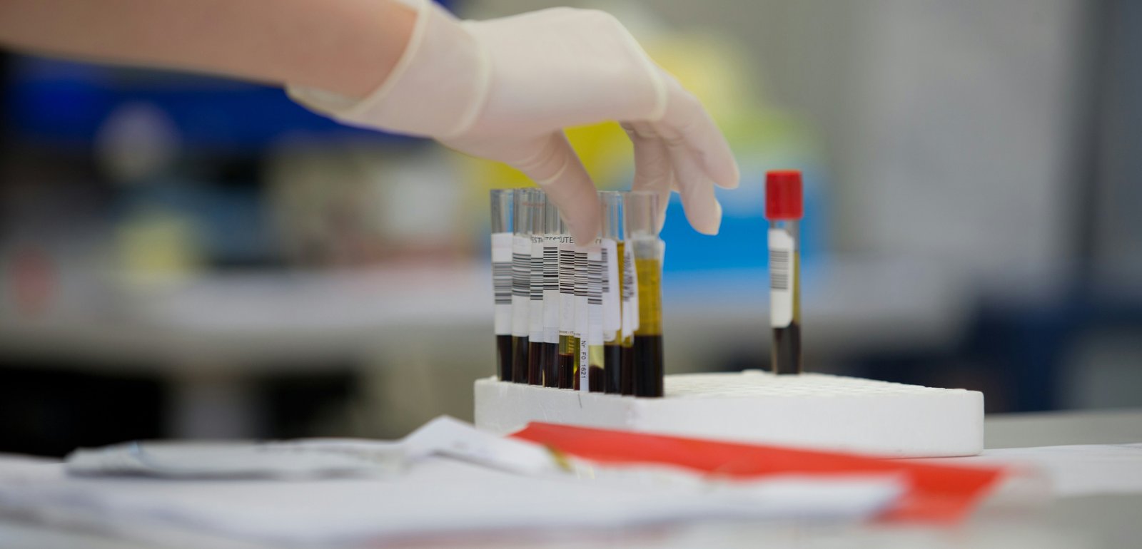 Ранние признаки болезни Паркинсона могут быть скрыты в крови