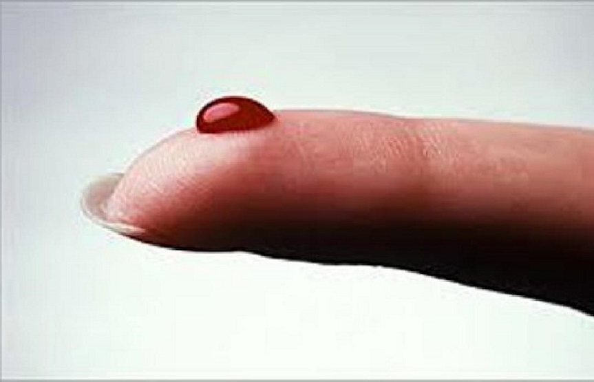 биосенсор, лаборатория на чипе, ФПИ, диагностика