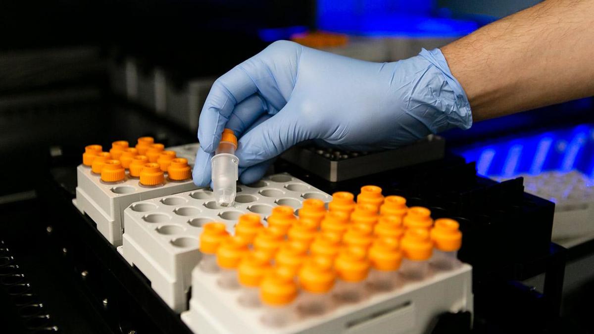 Эксперт Сивакова: удаление хромосомы у клеток с синдромом Дауна рискованно