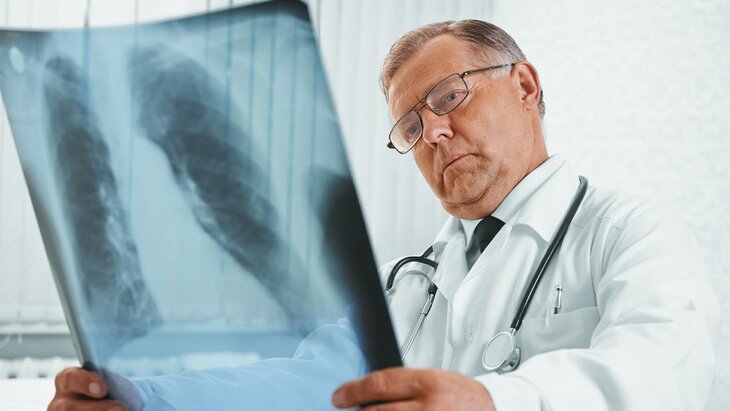 Главный пульмонолог Минздрава Авдеев призвал к массовой проверке россиян на ХОБЛ