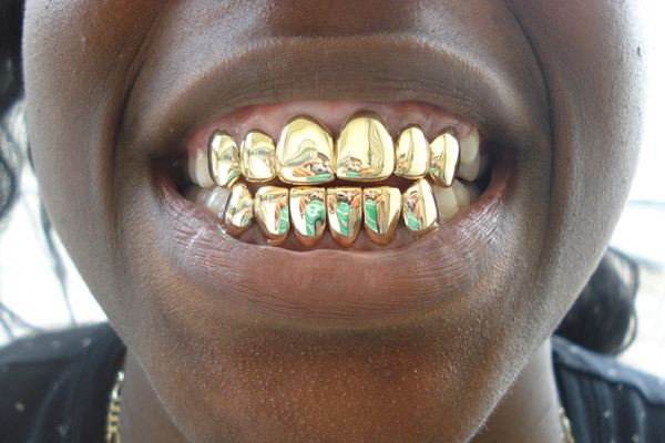 Gold Grillz.jpg