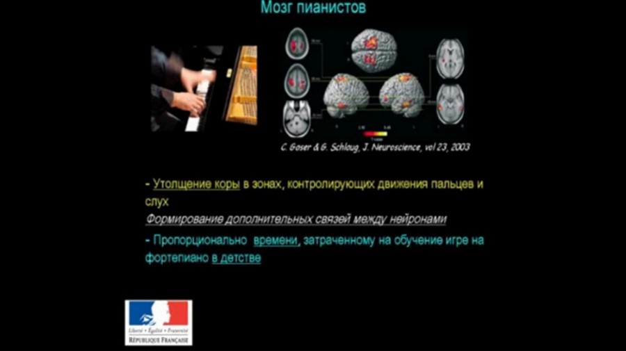виндаль18-2 Как устроен мозг