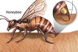 укус пчелы укус пчелы