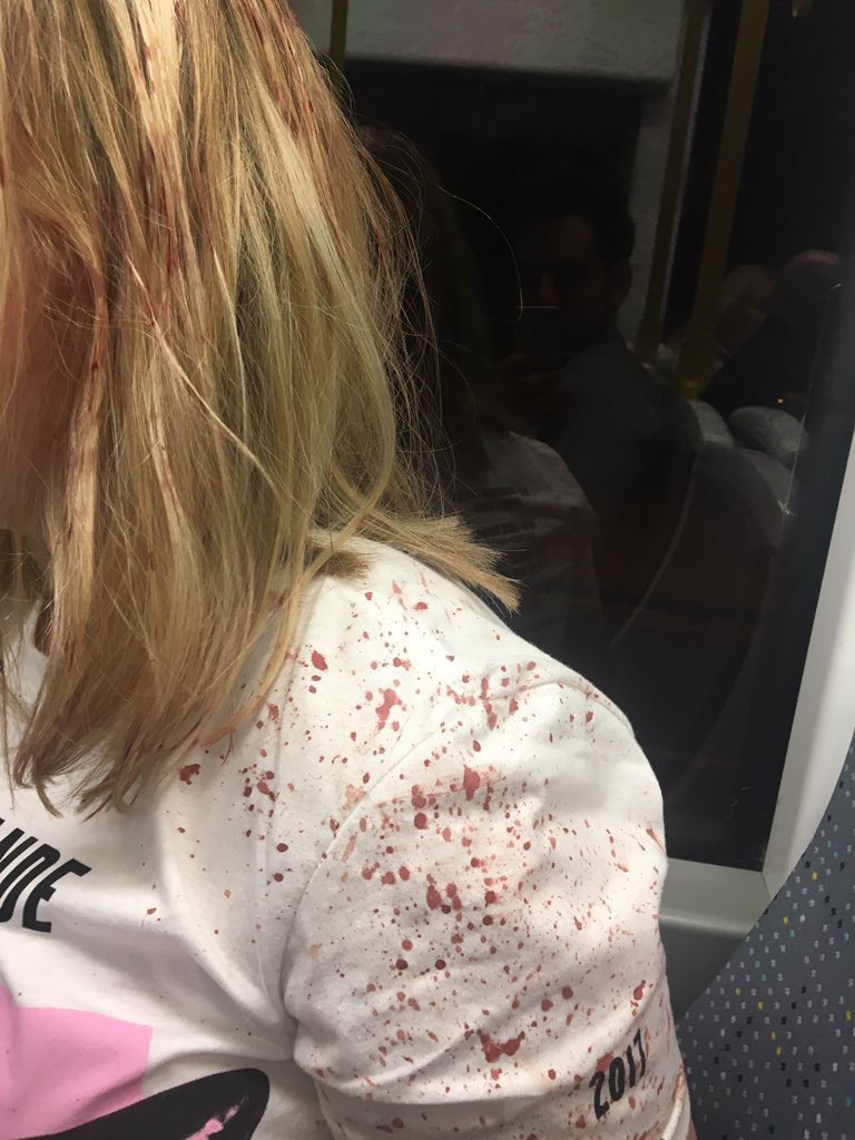 При взрыве на концерте в Манчестере погибли 20 человек При взрыве на концерте в Манчестере погибли 20 человек
