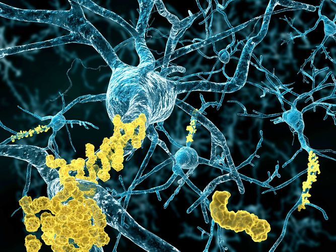 Ученые обнаружили вариант гена, дающий до 70% защиты от болезни Альцгеймера