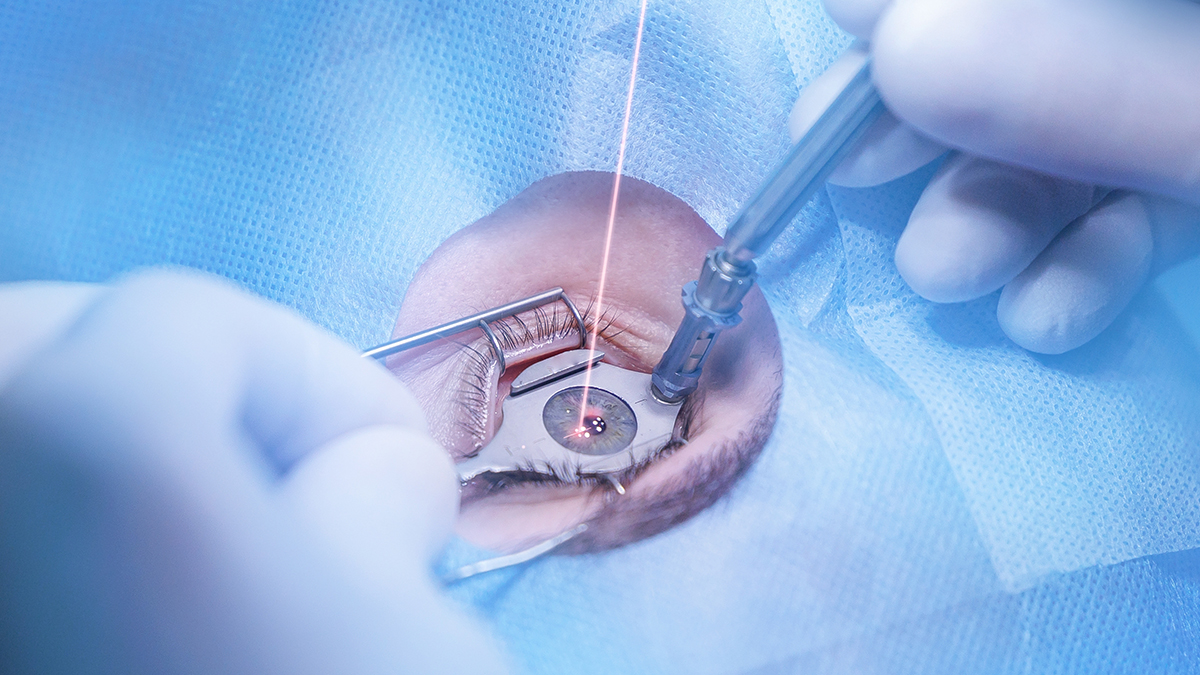 Прорыв или огромный риск? Что известно о новом методе коррекции зрения без операции за минуту