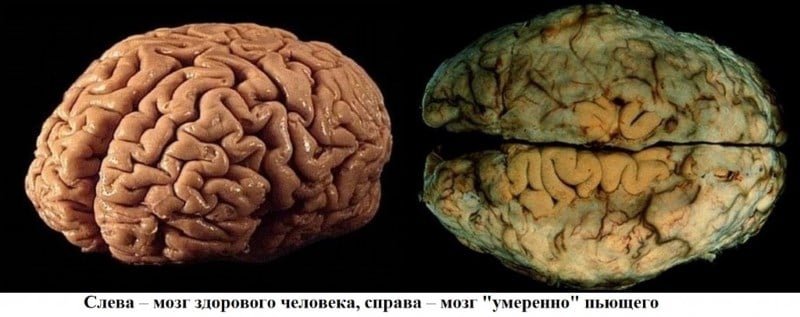 пагубное влияние алкоголя на человека