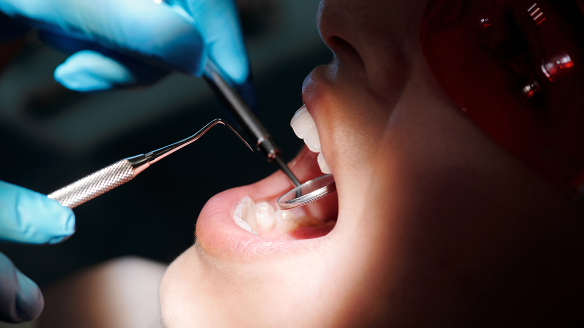 Стоматолог Кадькалова предупредила о зубной боли, которую перетерпеть не получится