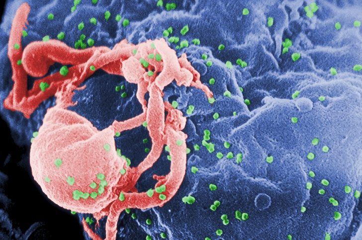 Мифы о вирусе иммунодефицита человека
