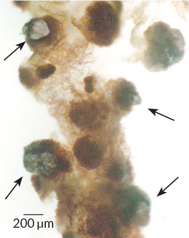 bug guts