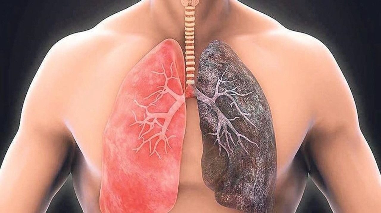 Ученые выяснил, как ХОБЛ влияет на кровеносные сосуды