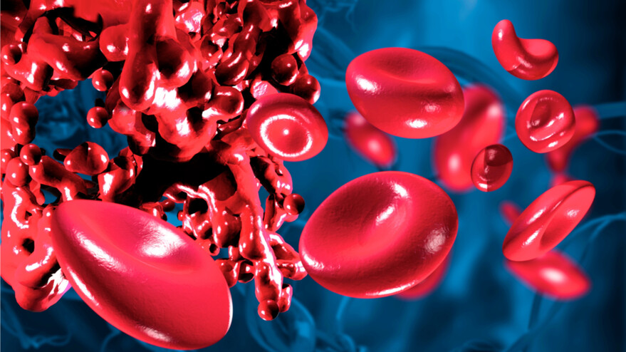 Продукты, разжижающие кровь: остановите голодание внутренних органов и тромбоз