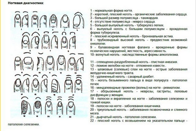 Что может сказать о человеке форма ногтей Что может сказать о человеке форма ногтей