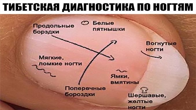 domashnie-tsveti-na-kotorih-net-allergii-foto-2-20-24-4