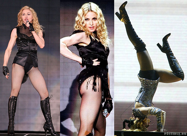 Madonna Plastic Surgery