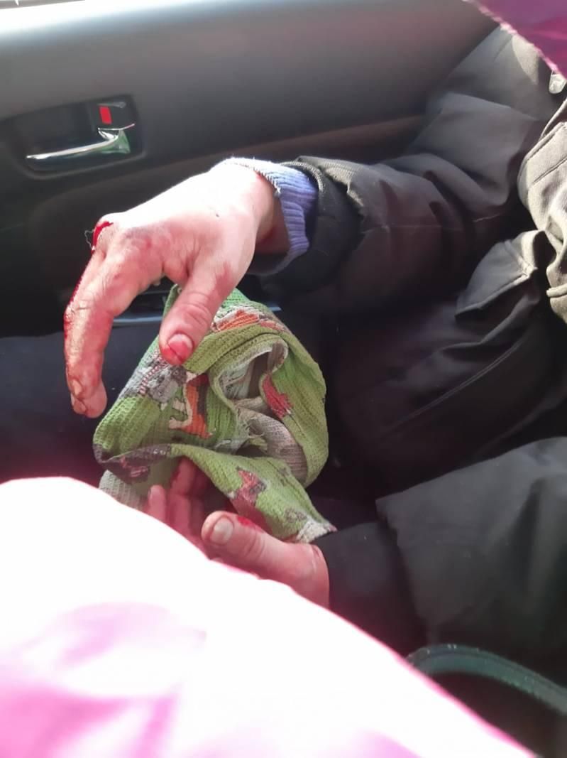 В Якутске голодные алабаи набросились на 14-летнего пацана В Якутске голодные алабаи набросились на 14-летнего пацана