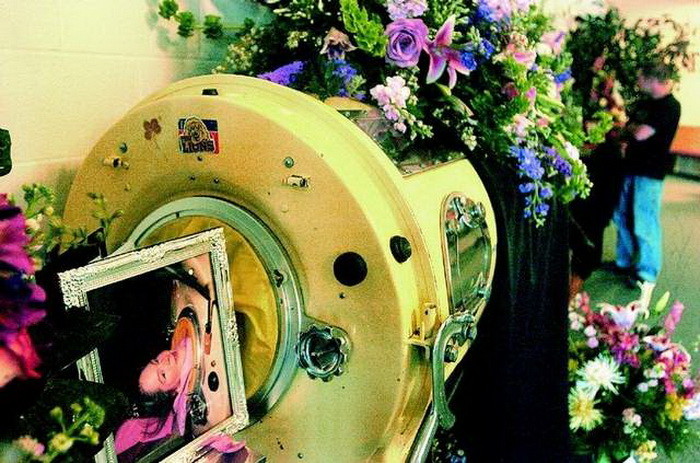 Диана провела 60 лет в аппарате искусственной вентиляции легких Диана провела 60 лет в аппарате искусственной вентиляции легких