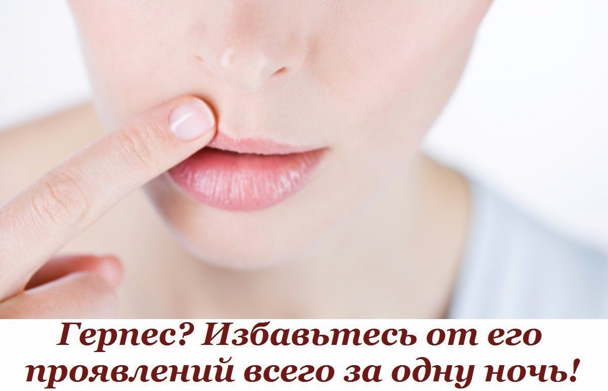 Как быстро избавиться от простуды на губе в домашних условиях за один день Как быстро избавиться от простуды на губе в домашних условиях за один день