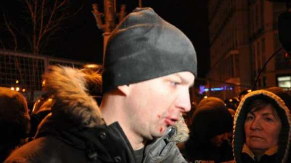«Это не украинская полиция, это ДНР! Беркут жив!»: в центре Киева избили депутата | Продолжение проекта «Русская Весна»