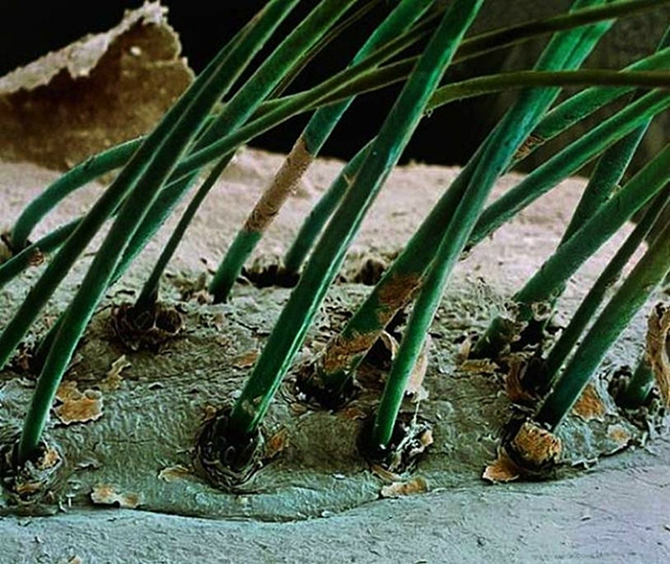 15 удивительных созданий, которых не разглядеть без микроскопа