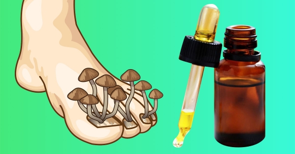 Как вылечить грибок на ногах с помощью эфирного масла