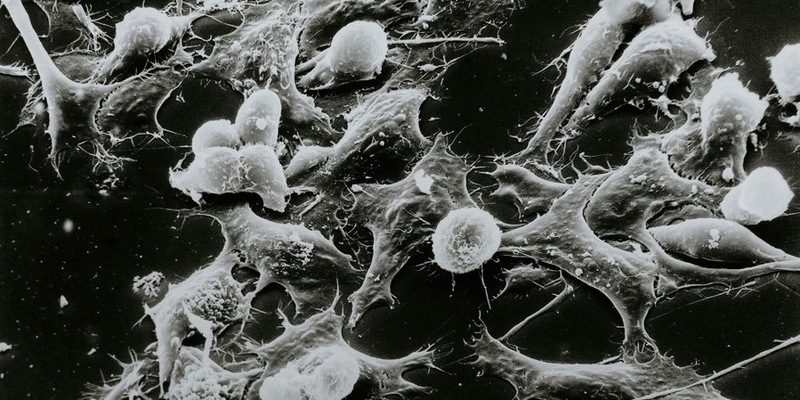 Открытие генетической цепи помогает объяснить миграцию клеток при раке