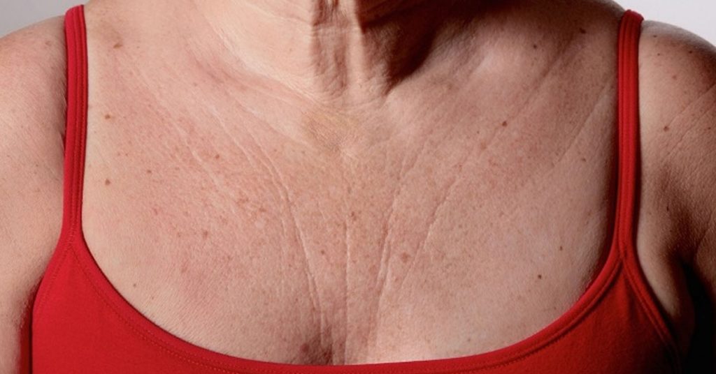 3 средства быстро устранят морщины на груди и шее
