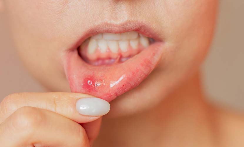 Стоматолог назвала опасные для здоровья симптомы во рту