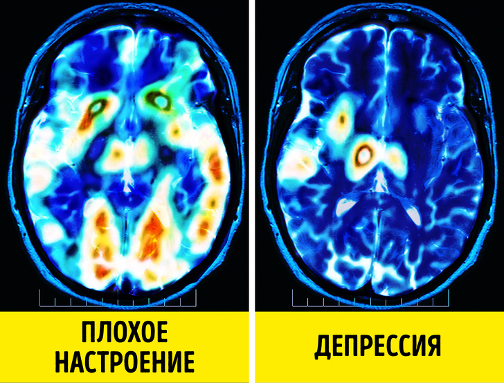 Почему с каждым днем становится все меньше нормальных людей