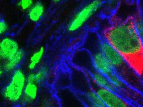 Клетки желудочного органоида под флуоресцентным микроскопом. Изображение Cincinnati Children's Hospital Medical Center