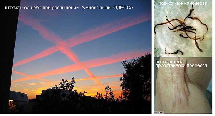 Это не болезнь Моргеллонов!!