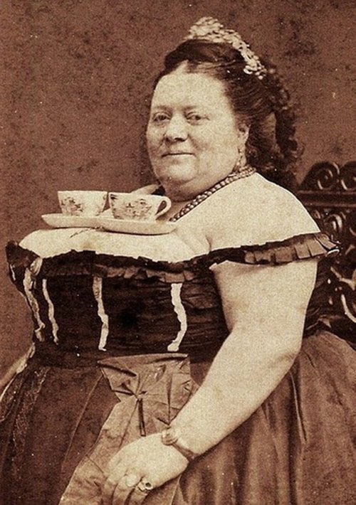Увеличение груди 100 лет назад. Как это было?