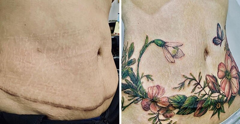 25 татуировок для перекрытия шрамов и других дефектов на теле