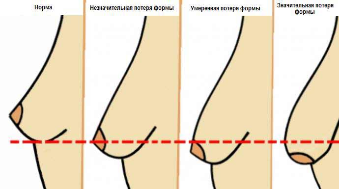 какие избавиться жира на животе какие избавиться жира на животе