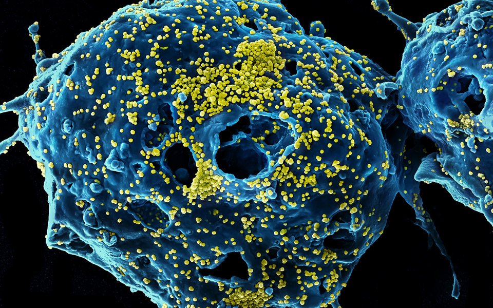 Что нужно знать про коронавирус из Китая и надо ли бояться эпидемии: 8 главных вопросов
