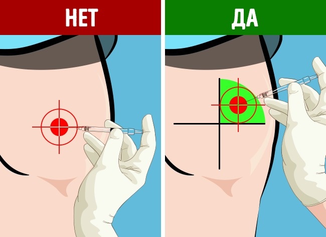 Как сделать укол мелоксикам в домашних условиях 7 Как сделать укол мелоксикам в домашних условиях 7