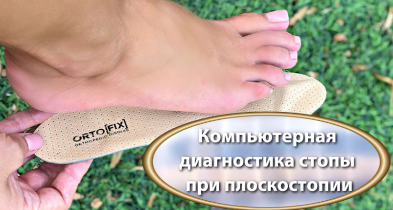 Ортопедические стельки Ортопедические стельки