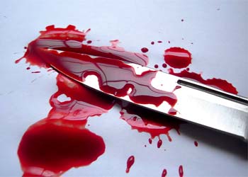 КАК ВЫЖИТЬ ПРИ РАНЕНИИ В НОЖЕВОЙ И РУКОПАШНОЙ СХВАТКЕ
