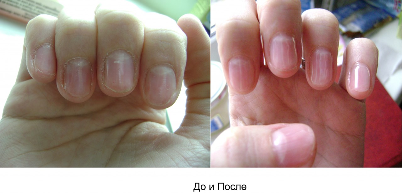 Ногти укрепление гелем