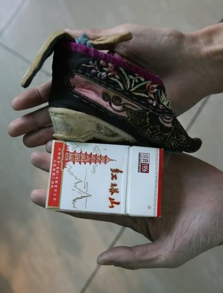 Китайские "лотосовые ножки" -"lily feet"- и ужасающие подробности этого обычая Китайские "лотосовые ножки" -"lily feet"- и ужасающие подробности этого обычая