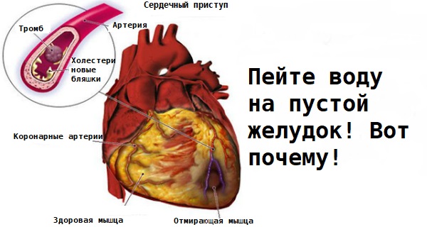treat-these-22-conditions-by-drinking-water-on-an-empty-stomach